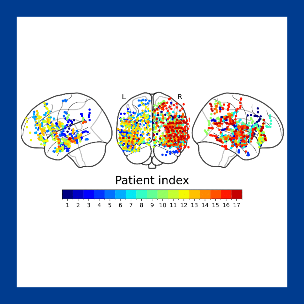 albouy workshop seeg mai 2026
